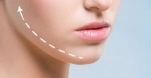 玻尿酸丰下巴会留痕迹吗 爱美的你一定要知...