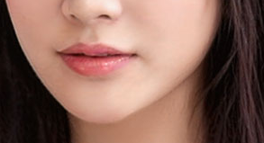 激光脱毛 让体毛陷入集体断更