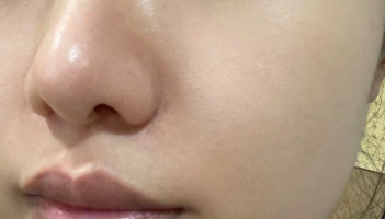 想让皮肤 “冻龄”？医美项目 + 护肤干货全奉上