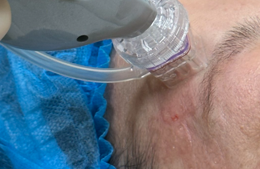 解决肌肤干躁 让你自带“高光”