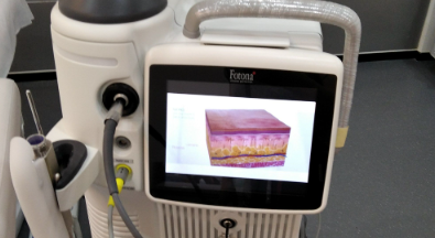 眼袋、泪沟、细纹找上门？Fotona 4D Pro无创抗衰，重塑眼周紧致感