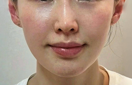 面部抗衰老与年轻化综合治疗