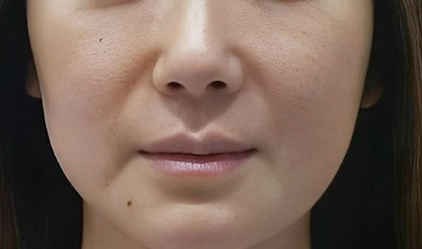 科学抗衰指南：解锁面部年轻化的正确方式