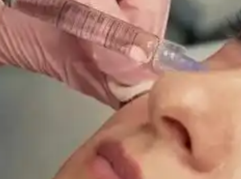 警惕美丽背后的风险：注射美容的“危肌”时...