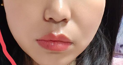 面部美学--科学定制你的“高级脸”高