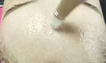 理性认识“中胚层疗法”（水光）